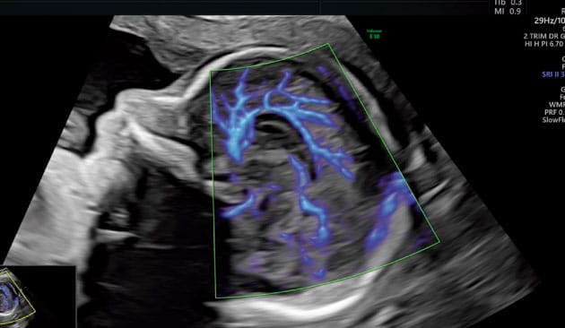 neurosonografia fetal vientre materno